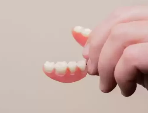 How Strong are Crowns on Front Teeth?