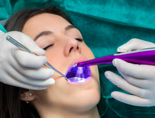 How Can Dental Sealants Prevent Cavities?